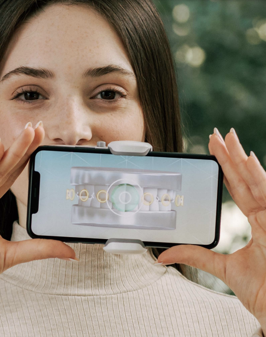 Orthodontie et dental monitoring 2